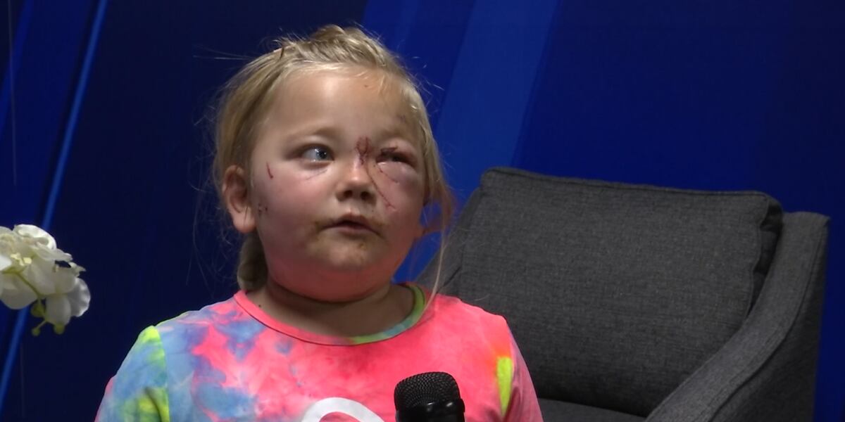 Boy saves 6-year-old sister during dog attack: 'I didn't want her to die'